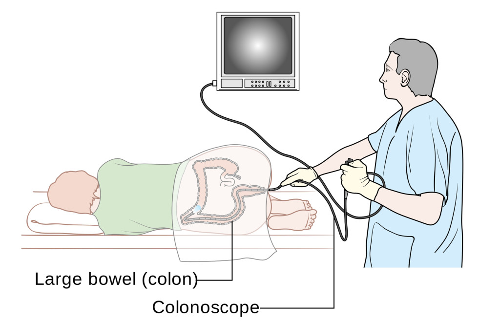 Colonoscopy exam