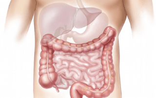 Colonoscopy Beverly Hills