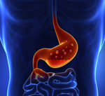 gi doctor near me Crohn's Colitis